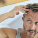 Middle-aged man concerned by hair loss